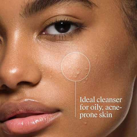 Neutrogena Oil-Free Acne Face Wash - Facial Cleanser with Salicylic Acid, Daily Cleanser for Oily & Acne-Prone Skin, Clears & Helps Prevent Breakouts, Clear Formula, 9.1 fl. oz. Bottle