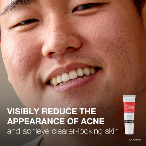 Neutrogena Rapid Clear Stubborn Acne Spot Treatment Gel with Maximum Strength 10% Benzoyl Peroxide Acne Treatment Medication, Pimple Cream for Acne Prone Skin Care, 1 oz, 2 Pack