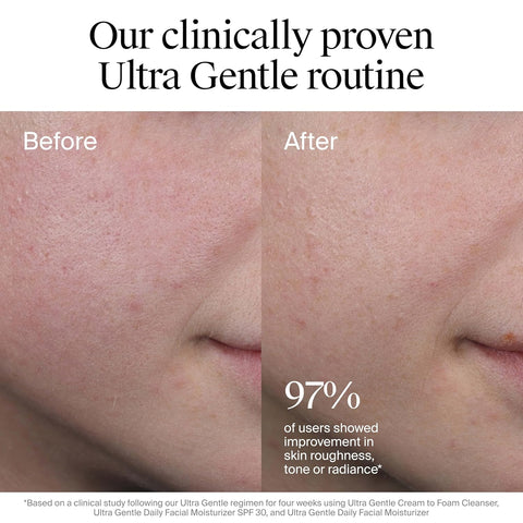 Neutrogena Ultra Gentle Daily Facial Moisturizer with SPF 30 Sunscreen with CICA, Lightweight Face Lotion with Broad Spectrum SPF 30 for Normal to Sensitive Skin, Fragrance-Free, 3.4 fl. oz